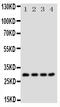 MYC Associated Factor X antibody, PA1768, Boster Biological Technology, Western Blot image 