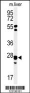 Glutathione S-Transferase Kappa 1 antibody, 64-156, ProSci, Western Blot image 