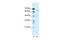 Acid Sensing Ion Channel Subunit 2 antibody, GTX47700, GeneTex, Western Blot image 