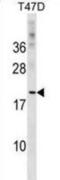 C-Type Lectin Domain Family 4 Member D antibody, abx029587, Abbexa, Western Blot image 