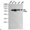 Pyruvate Kinase M1/2 antibody, LS-C813081, Lifespan Biosciences, Western Blot image 