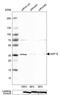 Growth Differentiation Factor 15 antibody, HPA011191, Atlas Antibodies, Western Blot image 