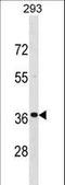 Troponin T3, Fast Skeletal Type antibody, LS-C160097, Lifespan Biosciences, Western Blot image 