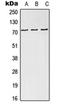 NDC80 Kinetochore Complex Component antibody, orb214983, Biorbyt, Western Blot image 