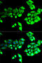 Bestrophin 1 antibody, LS-C749082, Lifespan Biosciences, Immunofluorescence image 