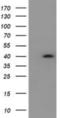 Hydroxysteroid 17-Beta Dehydrogenase 2 antibody, NBP2-01952, Novus Biologicals, Western Blot image 