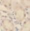 TBC1 Domain Family Member 5 antibody, FNab08515, FineTest, Immunohistochemistry paraffin image 