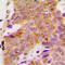 Ribosomal Protein S6 Kinase B1 antibody, LS-C352825, Lifespan Biosciences, Immunohistochemistry paraffin image 