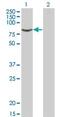 Activin A Receptor Type 2B antibody, ab76940, Abcam, Western Blot image 