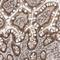 Zinc Finger Homeobox 4 antibody, HPA023837, Atlas Antibodies, Immunohistochemistry paraffin image 