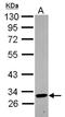 Killer Cell Immunoglobulin Like Receptor, Two Ig Domains And Long Cytoplasmic Tail 4 antibody, NBP2-17062, Novus Biologicals, Western Blot image 