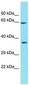 Golgi Associated Kinase 1B antibody, TA336039, Origene, Western Blot image 