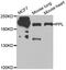 Periplakin antibody, abx005273, Abbexa, Western Blot image 