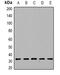 Deoxyguanosine Kinase antibody, abx141378, Abbexa, Western Blot image 