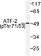 Activating Transcription Factor 2 antibody, LS-C177875, Lifespan Biosciences, Western Blot image 