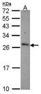 CD70 antigen antibody, GTX108452, GeneTex, Western Blot image 