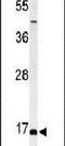 Biorientation Of Chromosomes In Cell Division 1 antibody, PA5-26968, Invitrogen Antibodies, Western Blot image 