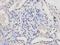Killer Cell Immunoglobulin Like Receptor, Two Ig Domains And Long Cytoplasmic Tail 3 antibody, orb48428, Biorbyt, Immunohistochemistry paraffin image 