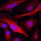 Glutathione S-transferase P 1 antibody, MAB6455, R&D Systems, Immunohistochemistry frozen image 