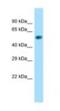 FHA-HIT-interacting protein antibody, NBP1-98433, Novus Biologicals, Western Blot image 