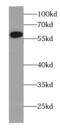 Cytochrome P450 Family 4 Subfamily Z Member 1 antibody, FNab02175, FineTest, Western Blot image 