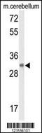 Diacylglycerol Lipase Beta antibody, 63-896, ProSci, Western Blot image 