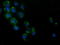 Hydroxyacid Oxidase 1 antibody, LS-C115788, Lifespan Biosciences, Immunofluorescence image 