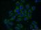 ELOVL Fatty Acid Elongase 4 antibody, 55023-1-AP, Proteintech Group, Immunofluorescence image 