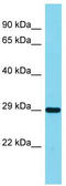 Interleukin 1 Receptor Associated Kinase 1 Binding Protein 1 antibody, TA343231, Origene, Western Blot image 