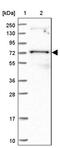 Pseudouridine Synthase 10 antibody, PA5-62015, Invitrogen Antibodies, Western Blot image 