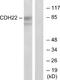 Cadherin 22 antibody, A14160, Boster Biological Technology, Western Blot image 