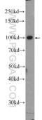 Cbl Proto-Oncogene antibody, 25818-1-AP, Proteintech Group, Western Blot image 