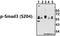 SMAD Family Member 3 antibody, A00059S204, Boster Biological Technology, Western Blot image 