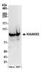 Cap-specific mRNA (nucleoside-2 -O-)-methyltransferase 1 antibody, NB100-79786, Novus Biologicals, Western Blot image 