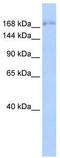 SPT6 Homolog, Histone Chaperone And Transcription Elongation Factor antibody, TA333888, Origene, Western Blot image 