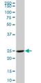 Cathepsin H antibody, H00001512-B01P, Novus Biologicals, Western Blot image 