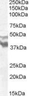 Dynein Axonemal Assembly Factor 4 antibody, NBP1-68815, Novus Biologicals, Western Blot image 