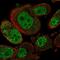 SET Domain Containing 6, Protein Lysine Methyltransferase antibody, PA5-65801, Invitrogen Antibodies, Immunofluorescence image 