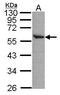 Aldehyde Dehydrogenase 2 Family Member antibody, PA5-27414, Invitrogen Antibodies, Western Blot image 