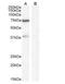 WIZ Zinc Finger antibody, NBP1-21059, Novus Biologicals, Western Blot image 