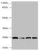 Glutathione S-Transferase Kappa 1 antibody, A57249-100, Epigentek, Western Blot image 