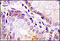 Platelet Derived Growth Factor Receptor Alpha antibody, 250816, Abbiotec, Immunohistochemistry paraffin image 