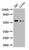 Aldehyde Dehydrogenase 1 Family Member A3 antibody, LS-C498339, Lifespan Biosciences, Western Blot image 