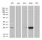 Glutathione S-Transferase Zeta 1 antibody, LS-C799084, Lifespan Biosciences, Western Blot image 