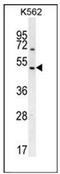 Regulator Of G Protein Signaling 7 antibody, AP53653PU-N, Origene, Western Blot image 