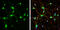 Glutamate Metabotropic Receptor 5 antibody, GTX133288, GeneTex, Immunofluorescence image 