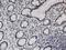 Polycomb Group Ring Finger 3 antibody, H00010336-M03, Novus Biologicals, Immunohistochemistry paraffin image 