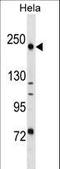 DLEC1 Cilia And Flagella Associated Protein antibody, LS-C159462, Lifespan Biosciences, Western Blot image 
