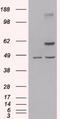 TNF Receptor Associated Factor 2 antibody, orb19446, Biorbyt, Western Blot image 