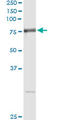 Arginyl Aminopeptidase antibody, LS-C198097, Lifespan Biosciences, Immunoprecipitation image 